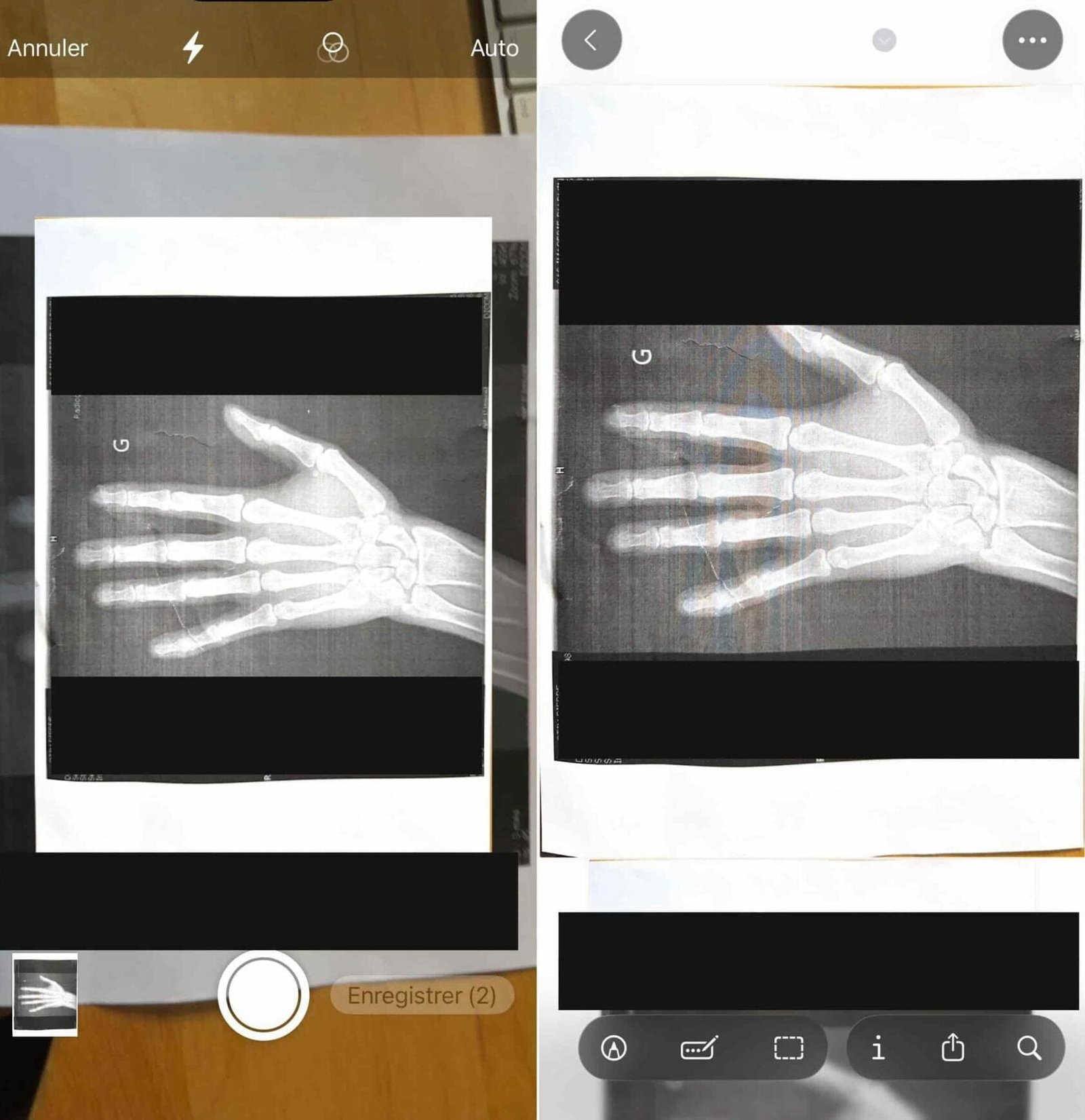 Preview iOS 26 scanner